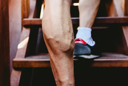 Book now a sclerotherapy service with Pampertree